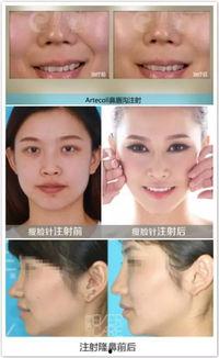 整形手术爆料视频大全最新,最新爆料视频大全深度解析 第3张 整形手术爆料视频大全最新,最新爆料视频大全深度解析 第3张